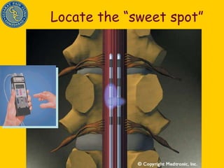 Locate the “sweet spot” 