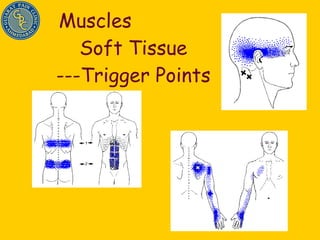Muscles  Soft Tissue ---Trigger Points 