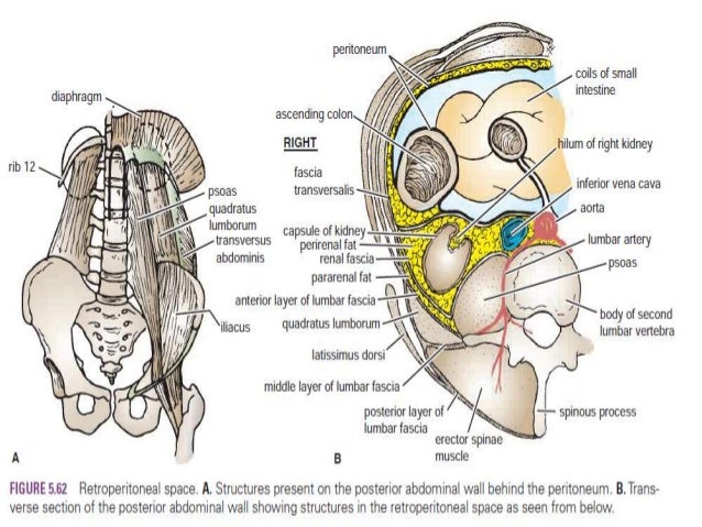 Back pain