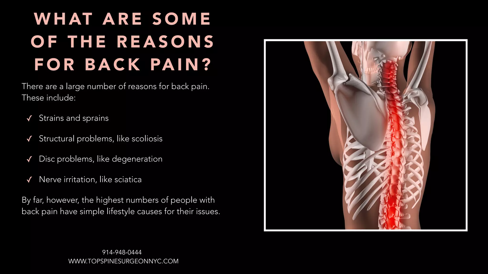 There are a large number of reasons for back pain.
These include:
✓ Strains and sprains
✓ Structural problems, like scoliosis
✓ Disc problems, like degeneration
✓ Nerve irritation, like sciatica
By far, however, the highest numbers of people with
back pain have simple lifestyle causes for their issues.
W H AT A R E S O M E
O F T H E R E A S O N S
F O R B A C K PA I N ?
WWW.TOPSPINESURGEONNYC.COM
914-948-0444
 