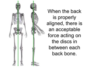When the back
    is properly
aligned, there is
 an acceptable
force acting on
   the discs in
 between each
   back bone.
 
