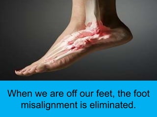 When we are off our feet, the foot
  misalignment is eliminated.
 
