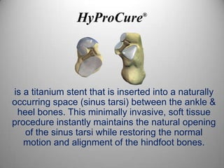 HyProCure        ®




is a titanium stent that is inserted into a naturally
occurring space (sinus tarsi) between the ankle &
 heel bones. This minimally invasive, soft tissue
procedure instantly maintains the natural opening
   of the sinus tarsi while restoring the normal
   motion and alignment of the hindfoot bones.
 