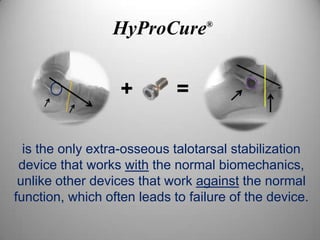 HyProCure        ®




                   +         =

  is the only extra-osseous talotarsal stabilization
 device that works with the normal biomechanics,
 unlike other devices that work against the normal
function, which often leads to failure of the device.
 