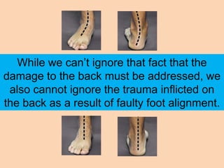 While we can’t ignore that fact that the
damage to the back must be addressed, we
 also cannot ignore the trauma inflicted on
the back as a result of faulty foot alignment.
 