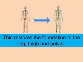 This restores the foundation to the
       leg, thigh and pelvis.
 
