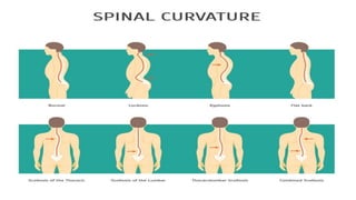 (BACK PAIN) (1).pptx