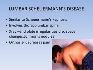 Back pain in children | PPTX