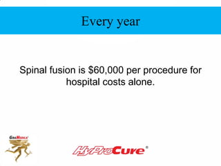 Every year
Spinal fusion is $60,000 per procedure for
hospital costs alone.
Every year
 