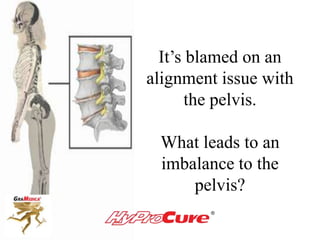 It’s blamed on an
alignment issue with
the pelvis.
What leads to an
imbalance to the
pelvis?
 