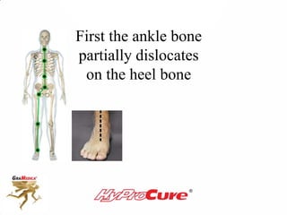 First the ankle bone
partially dislocates
on the heel bone
 