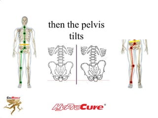 then the pelvis
tilts
 