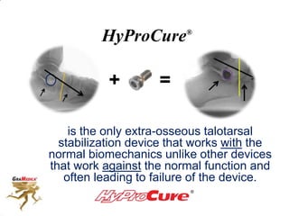 HyProCure®
is the only extra-osseous talotarsal
stabilization device that works with the
normal biomechanics unlike other devices
that work against the normal function and
often leading to failure of the device.
+ =
 