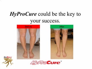 HyProCure could be the key to
your success.
Before After
 