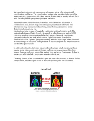 Various other treatments and management schemes are set up otherwise potential
complications could arise. The complications include urine retention, infections of the
upper respiratory, urinary tract infections, muscle degeneration or atrophy, chronic back
pain, thrombophlebitis, progressive paralysis, and so on.
Thrombophlebitis is inflammation of the veins, which formulate blood clots. If
complications arise, doctors may consider surgical procedures to intervene. The
interventions may include microdiskectomy, spinal fusion, percutaneous lateral
diskectomy, laminectomy, etc.
Laminectomy is the process of surgically excision the vertebral posterior arch. The
patient is administered fluids through I.V. as well as related treatment such as ROM
exercises, which are done prior to and after back surgery. Isometric exercises are
commonly ordered when back pain is present. Spinal fusions are described as
stabilizations of the “spinous” progressions along with the “bone chips” of the ilium and
its surroundings, or iliac crest. Harrington rods of metallic implants are potentials as well
and describe spinal fusions.
In addition to slip disks, back pain may arise from fractures, which may emerge from
trauma, aging, osteoporosis, steroid therapy, multiple myeloma, osteomyelitis, bone
tumors, Cushing syndrome, immobility, malnutrition, and so on. Fractures are defined in
many ways, which include compression, avulsion, simple, etc.
One thing for sure, when it comes to back pain one must take measures to prevent further
complications, since back pain is one of the worst possible pains one can endure.
 
