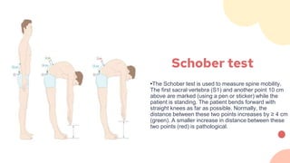 Schober test
•The Schober test is used to measure spine mobility.
The first sacral vertebra (S1) and another point 10 cm
above are marked (using a pen or sticker) while the
patient is standing. The patient bends forward with
straight knees as far as possible. Normally, the
distance between these two points increases by ≥ 4 cm
(green). A smaller increase in distance between these
two points (red) is pathological.
 