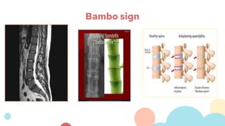 Bambo sign
 
