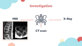 Investigation
MRI
CT scan
X-Ray
 