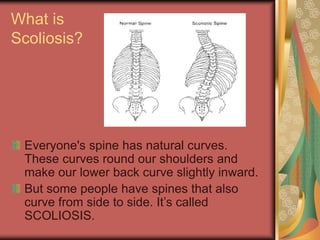 What is
Scoliosis?
Everyone's spine has natural curves.
These curves round our shoulders and
make our lower back curve slightly inward.
But some people have spines that also
curve from side to side. Its called
SCOLIOSIS.
 