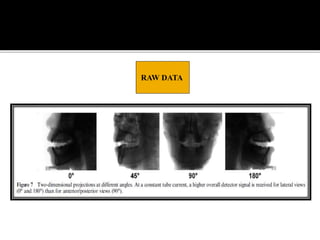 Back projection geometry in cbct