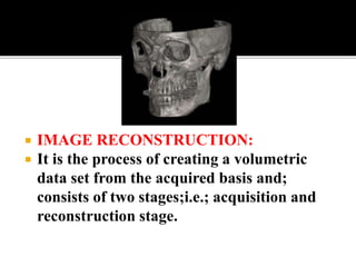 Back projection geometry in cbct