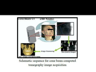 Back projection geometry in cbct