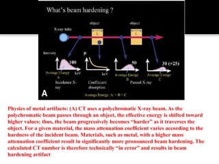 Back projection geometry in cbct