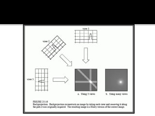 Back projection geometry in cbct