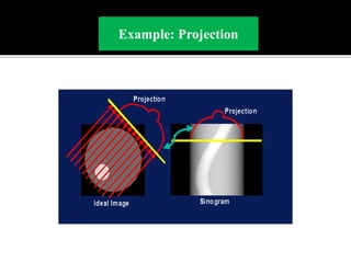 Back projection geometry in cbct