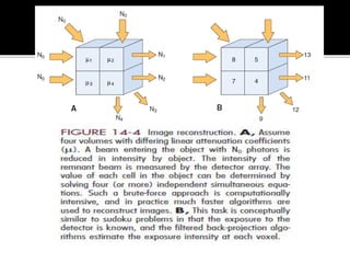 Back projection geometry in cbct