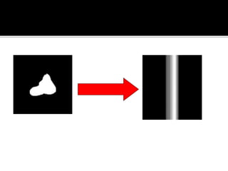 Back projection geometry in cbct