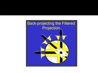Back projection geometry in cbct