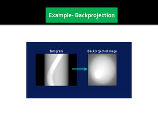 Back projection geometry in cbct