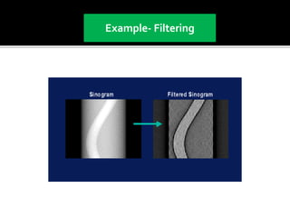 Back projection geometry in cbct