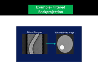 Back projection geometry in cbct