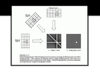 Back projection geometry in cbct