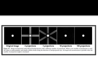 Back projection geometry in cbct