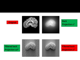 Back projection geometry in cbct
