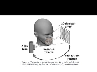 Back projection geometry in cbct
