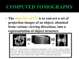 Back projection geometry in cbct