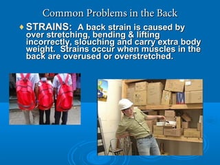 Common Problems in the BackCommon Problems in the Back
♦ STRAINS:STRAINS: A back strain is caused byA back strain is caused by
over stretching, bending & liftingover stretching, bending & lifting
incorrectly, slouching and carry extra bodyincorrectly, slouching and carry extra body
weight. Strains occur when muscles in theweight. Strains occur when muscles in the
back are overused or overstretched.back are overused or overstretched.
 