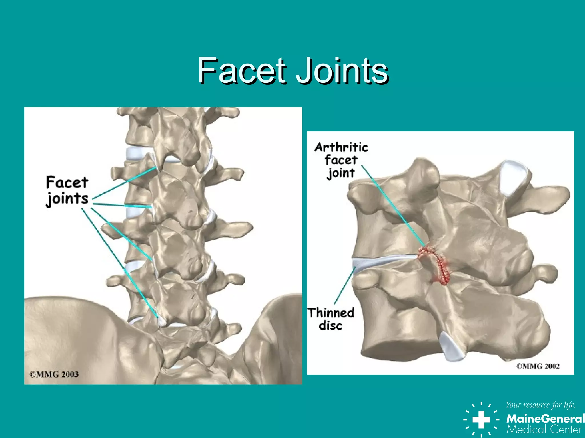 Facet JointsFacet Joints
 