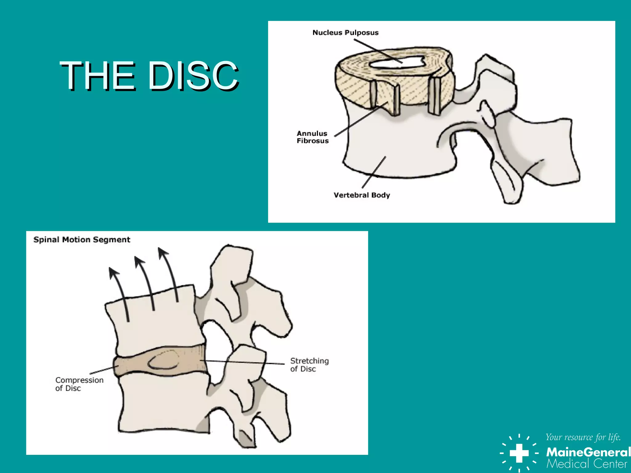 THE DISCTHE DISC
 