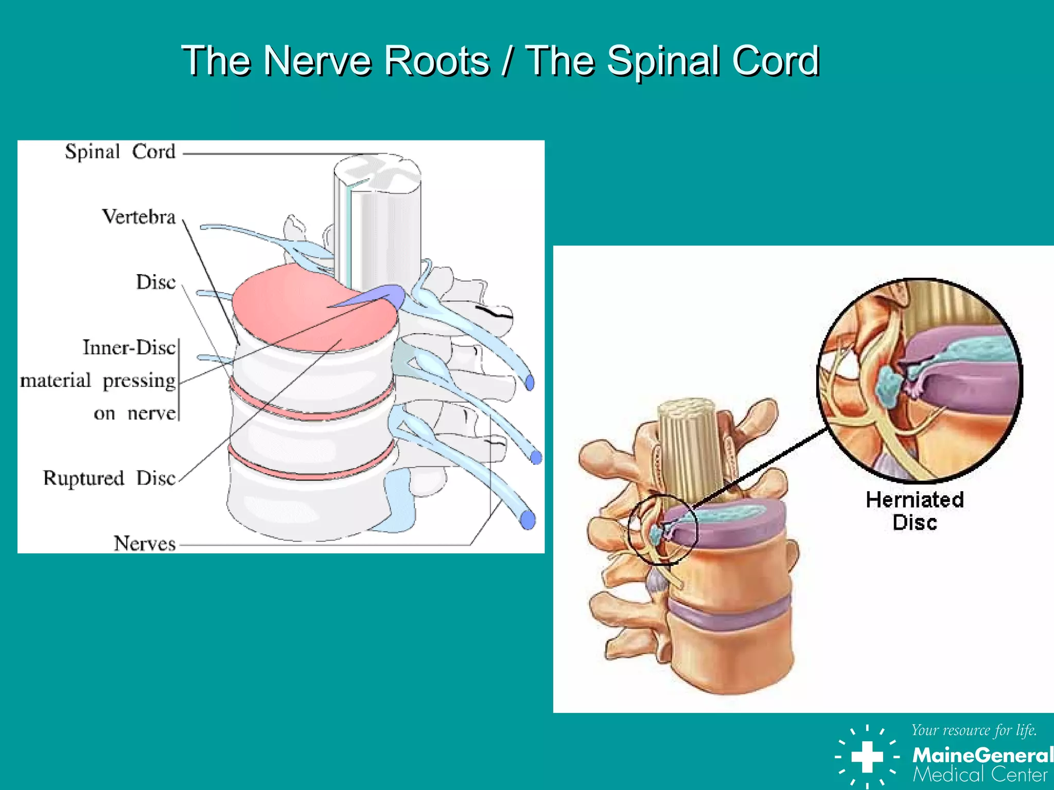 The Nerve Roots / The Spinal CordThe Nerve Roots / The Spinal Cord
 