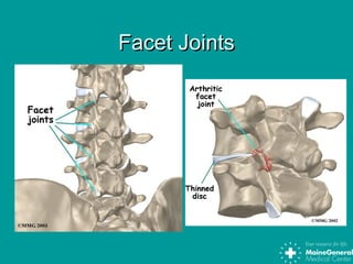 Facet JointsFacet Joints
 