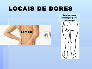 LOCAIS DE DORES Lombar com irradiação para  perna e pé Lombar ou                                                                    