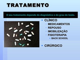 TRATAMENTO CLÍNICO MEDICAMENTOS REPOUSO IMOBILIZAÇÃO FISIOTERAPIA BACK SCHOOL CIRÚRGICO O seu tratamento depende do diagnóstico e do grau de lesão. 