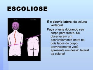ESCOLIOSE É o  desvio lateral  da coluna vertebral.  Faça o teste dobrando seu corpo para frente. Se observarem um desnivelamento entre os dois lados do corpo, provavelmente você apresenta um desvio lateral da coluna! 