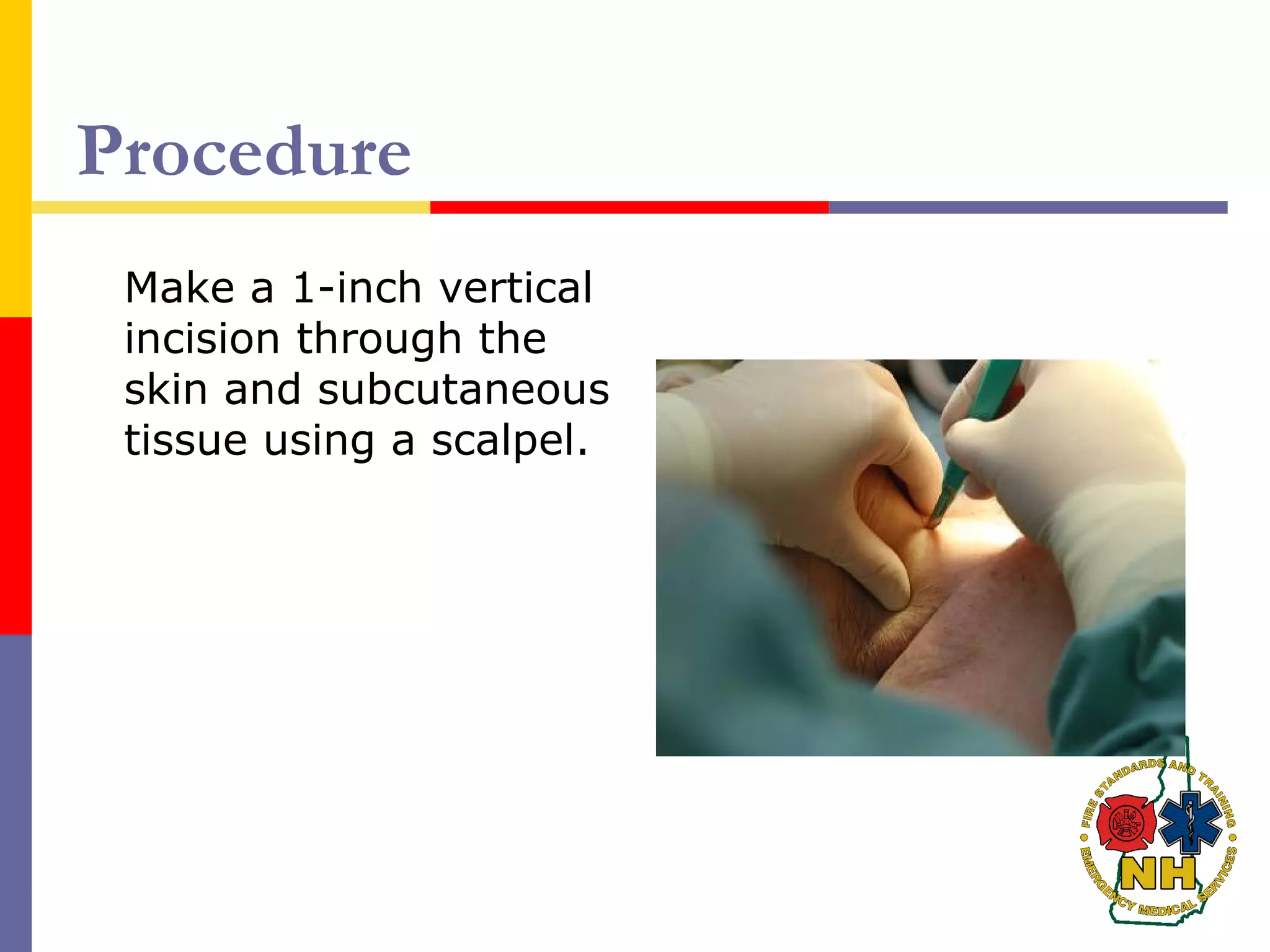 Procedure
Make a 1-inch vertical
incision through the
skin and subcutaneous
tissue using a scalpel.
 