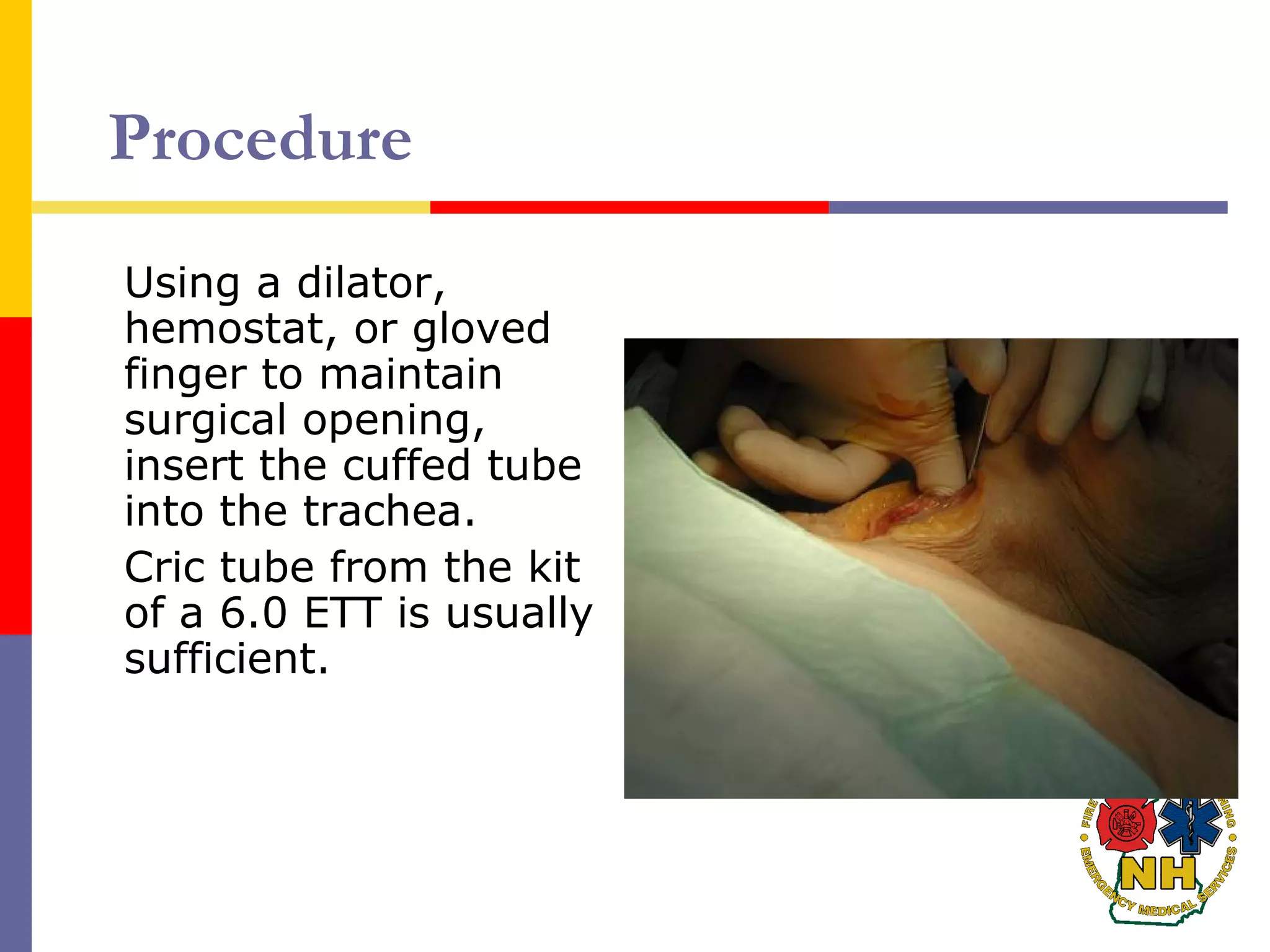 Procedure
Using a dilator,
hemostat, or gloved
finger to maintain
surgical opening,
insert the cuffed tube
into the trachea.
Cric tube from the kit
of a 6.0 ETT is usually
sufficient.
 